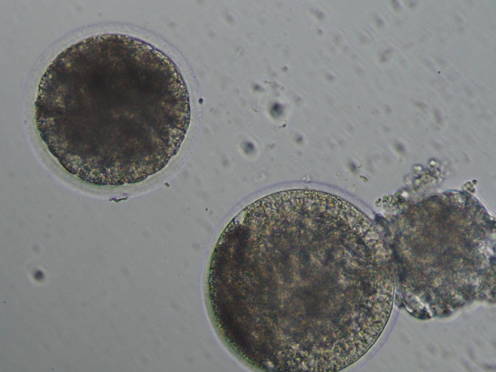 ICSI Image_1