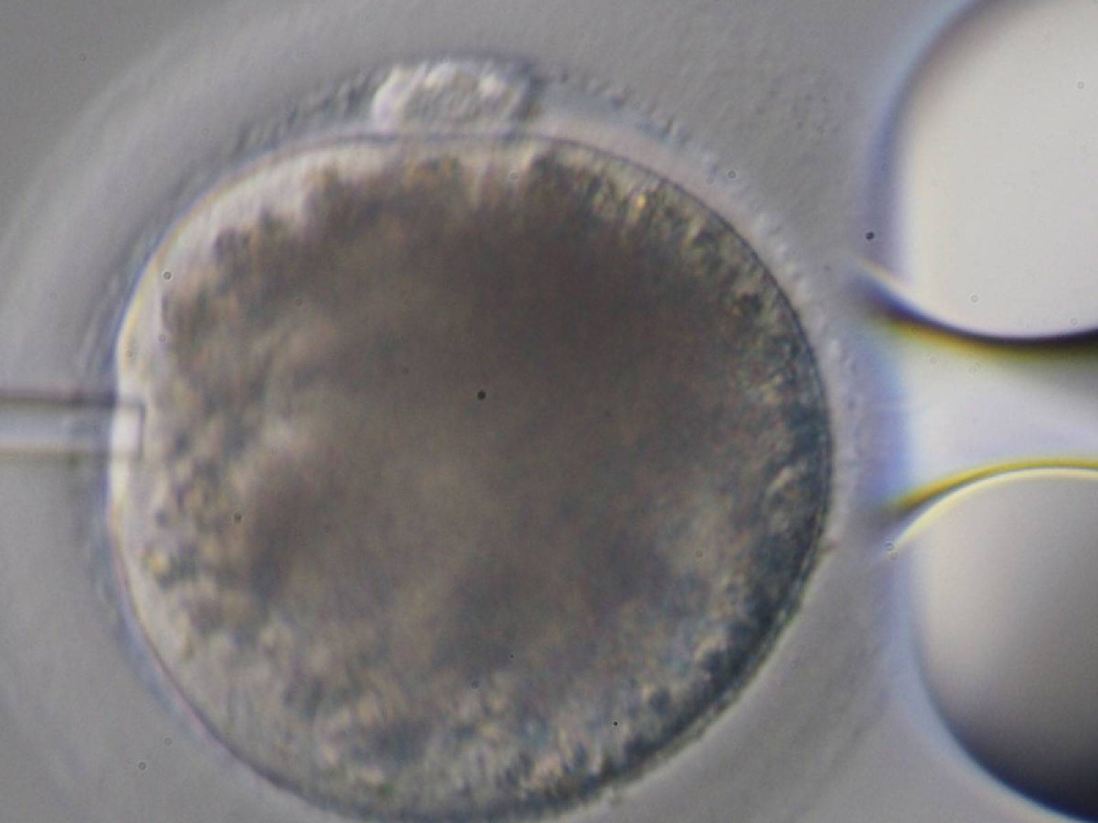 ICSI Image_3